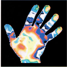 Image of thermograph of human hand