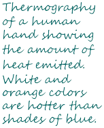 Thermography of a human hand showing the amount of heat emitted. White and orange colors are hotter than shades of blue.